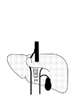 schematic representation of the liver